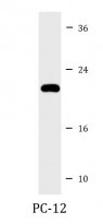 Anti-TMED10 / TMP21