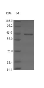 Coagulation factor XII (F12), partial, swine, recombinant