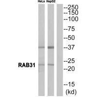Anti-RAB31