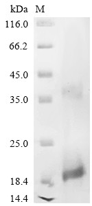 Slit homolog 3 protein (SLIT3), partial, human, recombinant