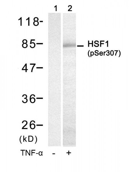 Anti-phospho-HSF1 (Ser307)