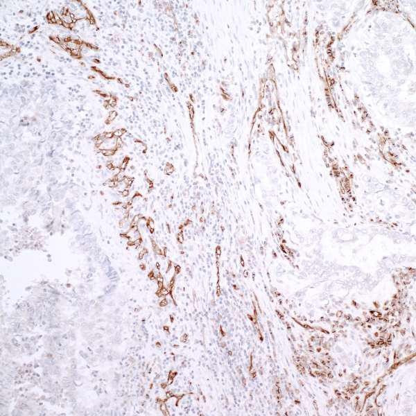 Anti-CD31 (IHC)