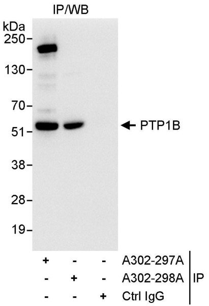 Anti-PTP1B