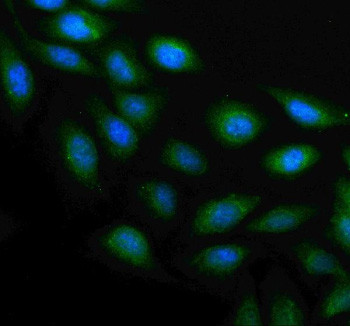 Anti-PLAAT4 / RARRES3