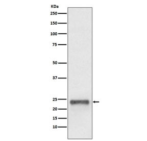 Anti-FAT10 / Ubiquitin D / UBD, clone HID-21