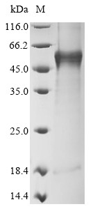 Tyrosinase (Tyr), mouse, recombinant