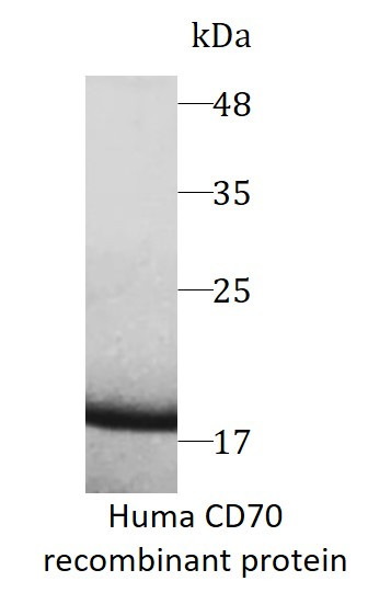 Huma CD70 recombinant protein (Active) (His-tagged)