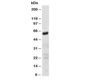 Anti-CD147