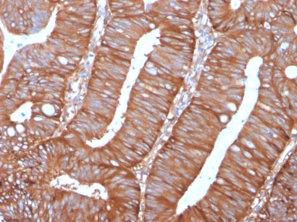 Anti-Calpastatin, clone CAST/1550