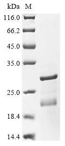 Protein phosphatase 1 regulatory subunit 1B (PPP1R1B), human, recombinant
