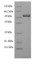 Hyaluronan synthase 2 (Has2), partial, mouse, recombinant