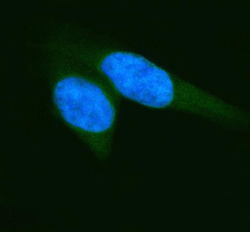 Anti-ELP2 / Elongator complex protein 2