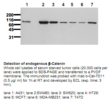 Anti-beta-Catenin (N-term) (exon 2), clone 7D11