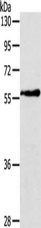 Anti-OLFM4