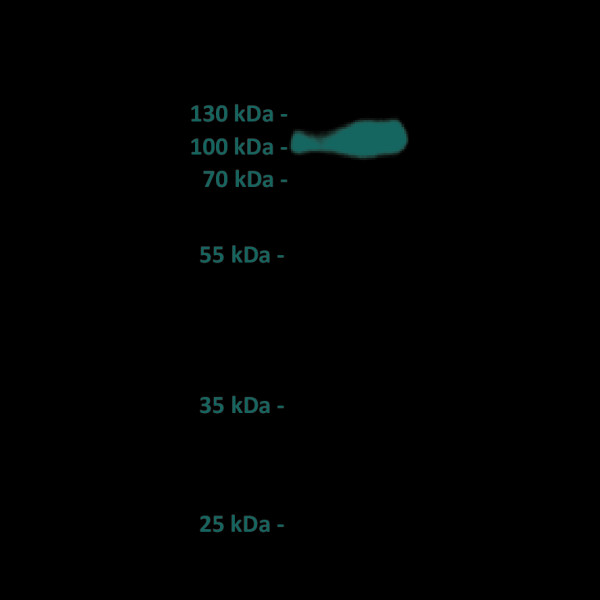 Anti-CD19 antibody(11B2), IgG1 Chimeric mAb