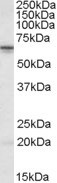 Anti-STK39 / SPAK, Internal