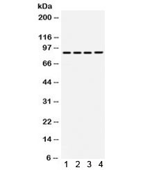 Anti-TGFBR2 / TGF beta Receptor II