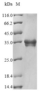 Endothelin-1 (Edn1), partial, rat, recombinant