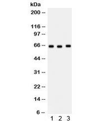 Anti-SLC19A1