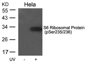 Anti-Phospho-RPS6 (Ser235/236)
