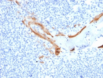 Anti-KRT16 / Cytokeratin 16, clone SPM264