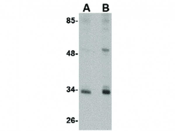 Anti-CUEDC2