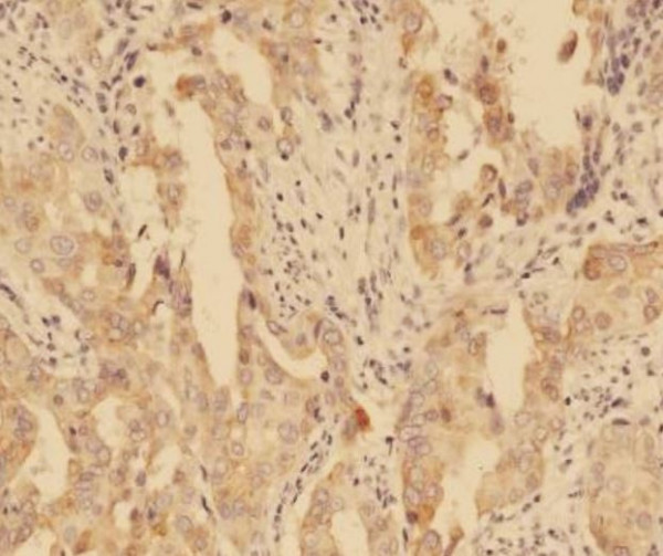 Anti-EGFR (L858R), clone SQab20189