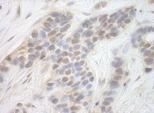 Anti-CDK8 (IHC)