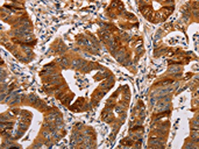 Anti-ALDH3A1