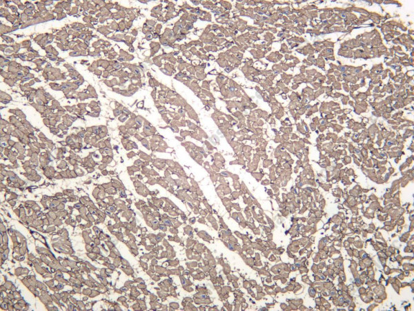 Anti-Recombinant COL6A2, clone C112502