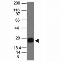 Anti-HLA-DRB1 (MHC II), clone HLA-DRB/1067