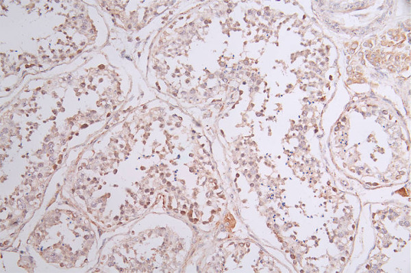 Anti-SOCS7 Recombinant Monoclonal, clone 23E4