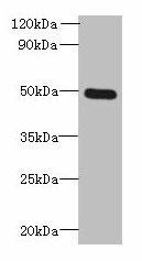 Anti-TTYH1