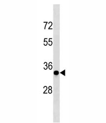 Anti-Cyclin D3 (CCND3)