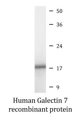 Human Galectin 7 recombinant protein (Active)