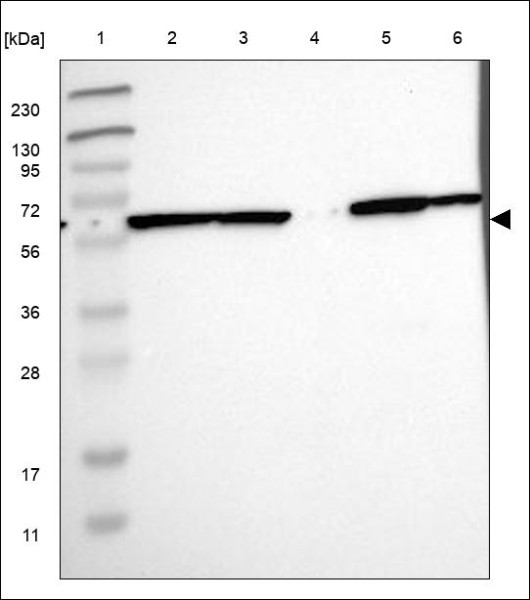Anti-VIPR1