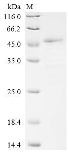 Collagen alpha-1 (I) chain (COL1A1), partial, recombinant human