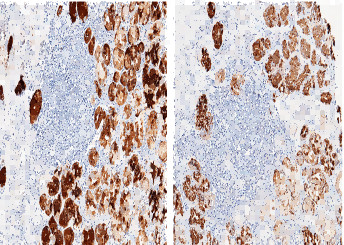 Anti-Pepsinogen C/PGC Monoclonal Antibody