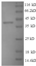 Thrombospondin-1 (Thbs1), partial, mouse, recombinant