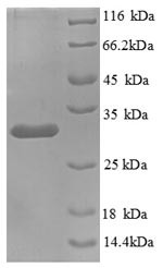 Kininogen-1 (KNG1), partial, human, recombinant