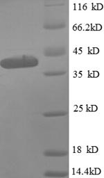 50S ribosomal protein L9 (rplI), partial, Escherichia coli, recombinant