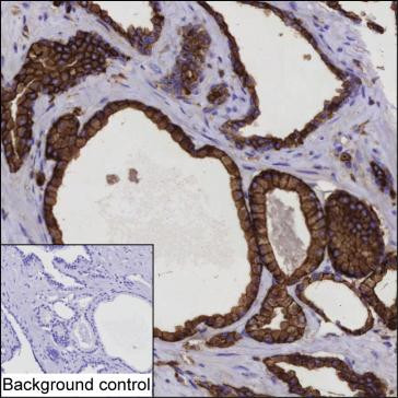 Anti-IQGAP2