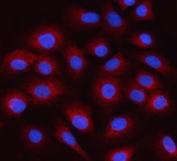 Anti-ALS2CR2 / ILPIP