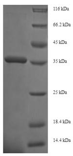 Integrin alpha-2 (ITGA2), partial, human, recombinant