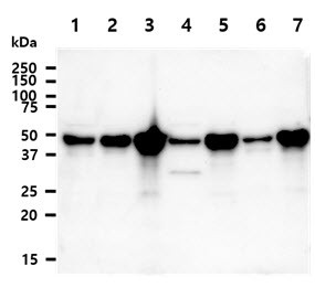 Anti-NDRG1, clone 11G4