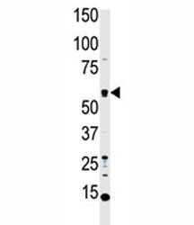 Anti-MST1 (Mammalian STE20-like protein kinase 1)