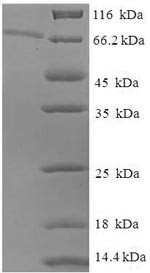 Epoxide hydrolase 1 (EPHX1), human, recombinant