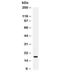 Anti-S100A8 / MRP8