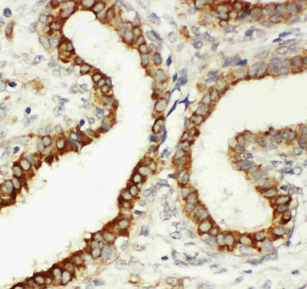Anti-CD61 / Integrin beta 3