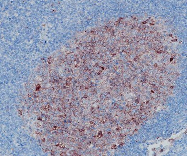 Anti-CD10, clone SQab18105